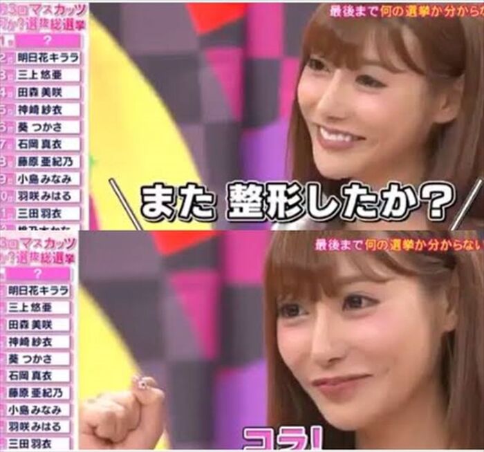 【Plastic Surgery】Asuka Kirara's latest version of 2020 is very popular wwwwwwwwww 7th image